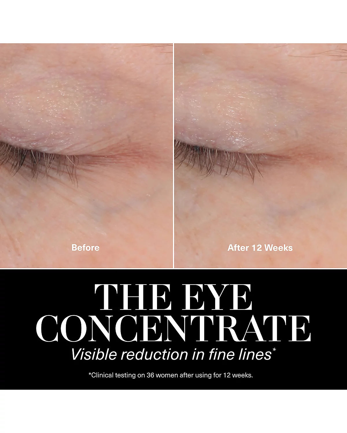 LA MER - The Eye Concentrate, 0.5 oz